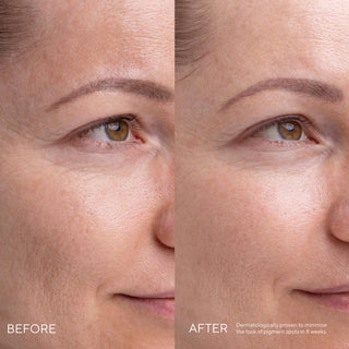 Kojic Alternative Pigment Serum